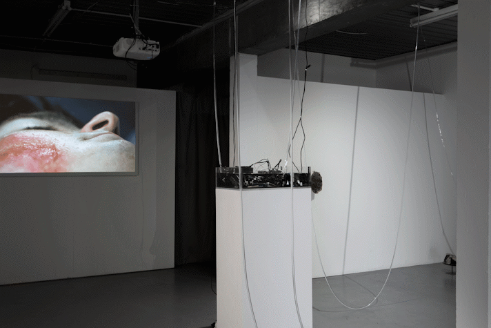A white room with translucen cables hanging from the ceiling. A video of a bruised cheek is projected on a screen.